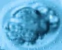 鲜胚、冻胚、囊胚该怎么选？哪个成功率高？