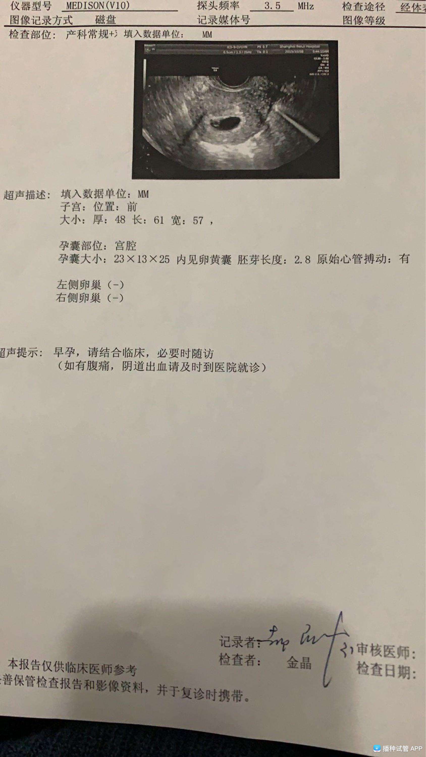 试管婴儿胎心生了试管婴儿后悔了