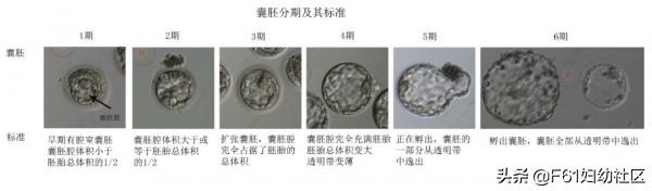试管婴儿的移植胚胎 试管婴儿的移植胚胎