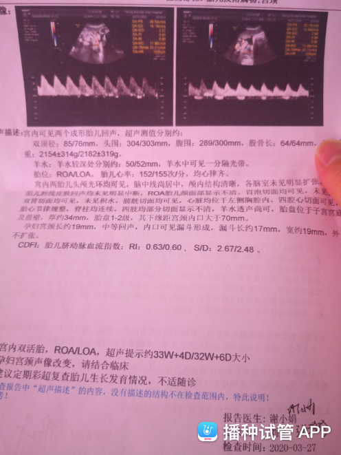 试管婴儿生双胞胎的几率有多大的简单介绍