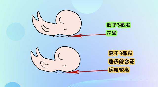 试管婴儿唐筛