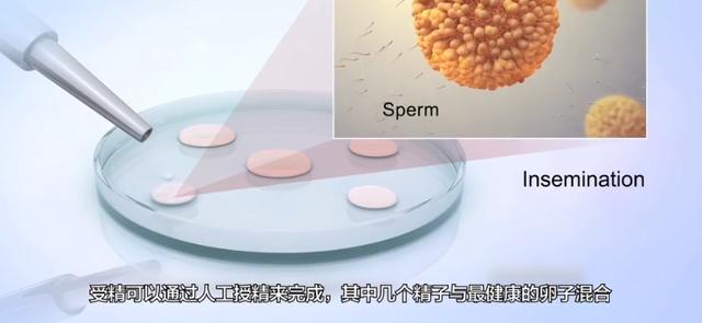 北医三院试管婴儿费用 北医三院试管婴儿费用