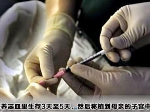 做试管婴儿女方会疼吗 做试管婴儿女方会疼吗