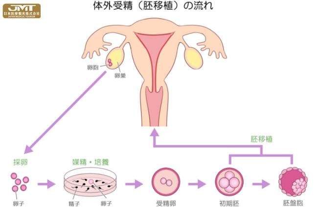 做一次试管婴儿大概要多少钱(试管婴儿跟人工受孕有什么区别)