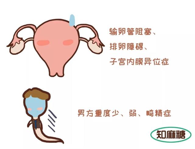 试管婴儿内容 试管婴儿内容