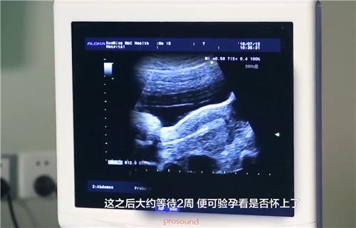 三院试管婴儿步骤 三院试管婴儿步骤