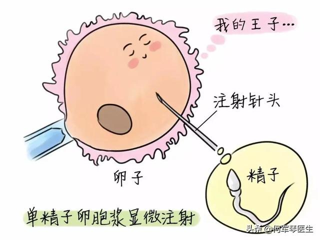 阳试管婴儿吗 阳试管婴儿吗
