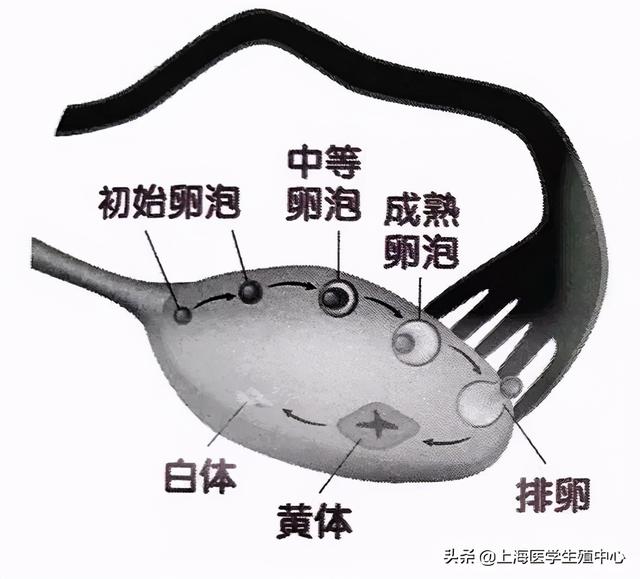 试管婴儿多囊卵巢 试管婴儿多囊卵巢