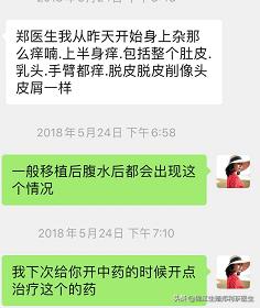 试管婴儿腹水症状 试管婴儿腹水症状