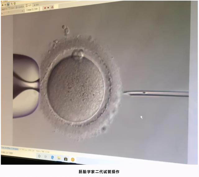 成功的试管婴儿 成功的试管婴儿