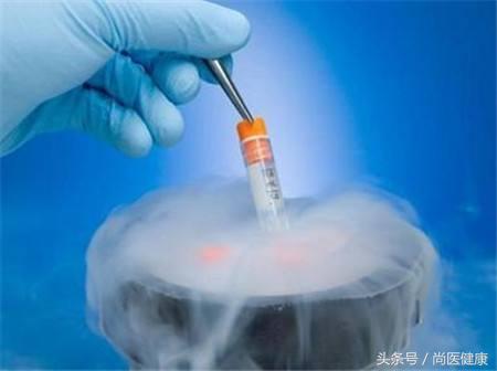 试管婴儿能避免畸形吗
