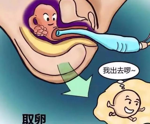 试管婴儿需要的时间 试管婴儿需要的时间