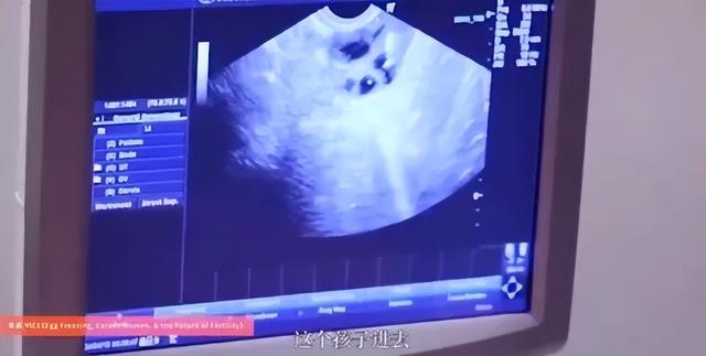 去美国做试管婴儿的 去美国做试管婴儿的
