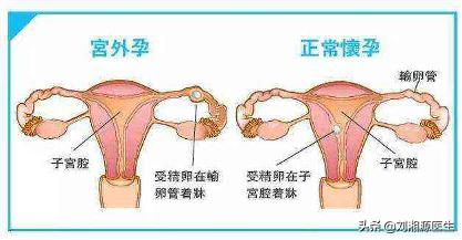 试管婴儿打瑞白的作用 试管婴儿打瑞白的作用