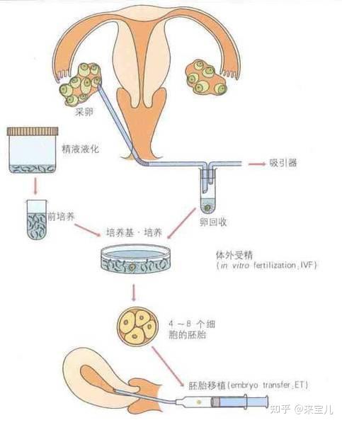 试管婴儿需多钱(千万不要做试管婴儿)
