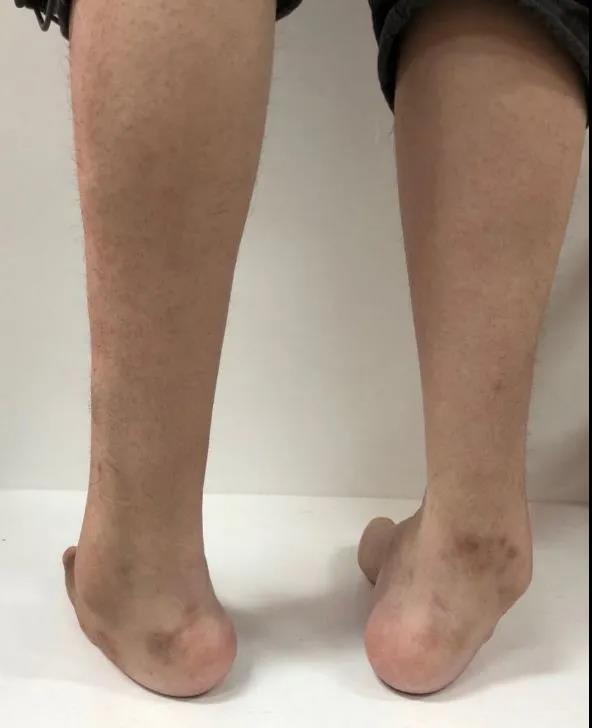 妇幼保健院试管婴儿 妇幼保健院试管婴儿