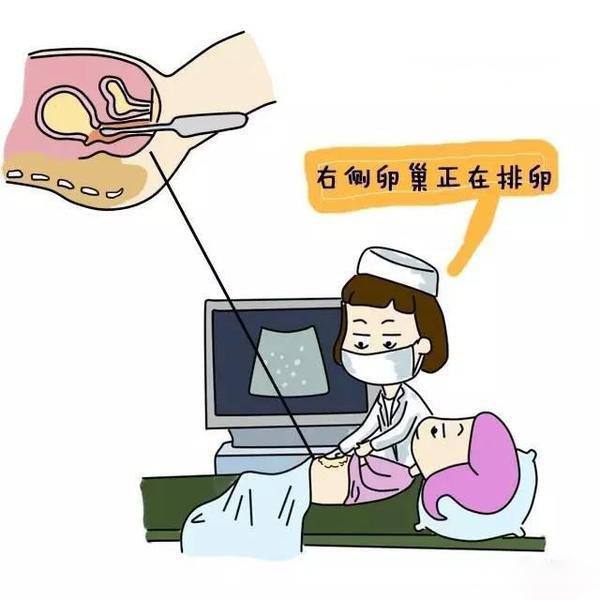 做试管婴儿之后的检查试管婴儿都需要做哪些检查