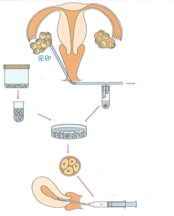 基督徒试管婴儿(试管婴儿违背基督教吗)