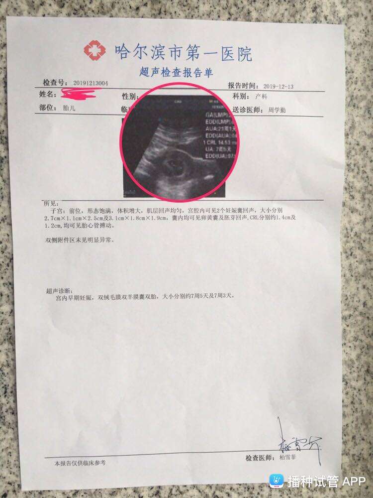 试管婴儿记录做试管婴儿的全部流程