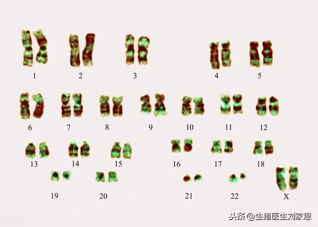 试管婴儿用做染色体(做试管染色体检查)