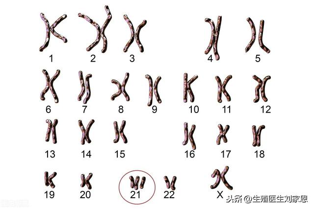 试管婴儿用做染色体 试管婴儿用做染色体
