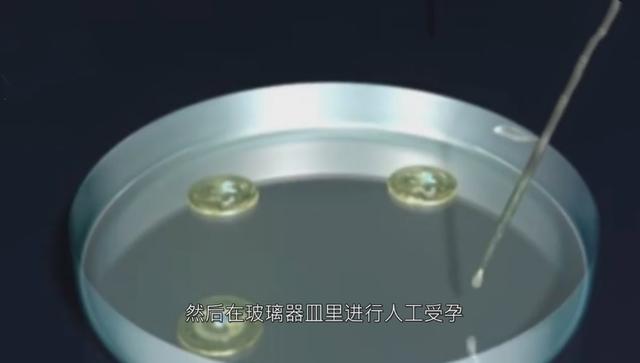 试管婴儿痛吗 试管婴儿痛吗
