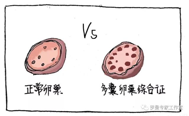 多囊做试管婴儿多囊能做试管婴儿吗