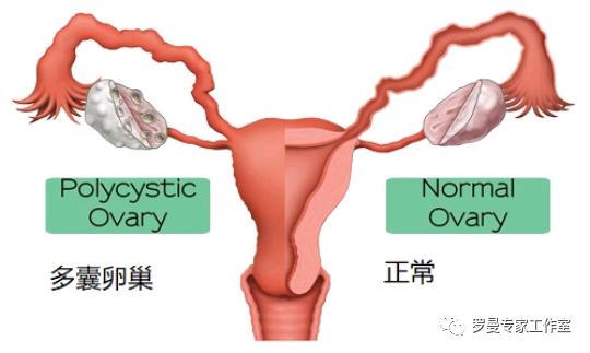 多囊做试管婴儿 多囊做试管婴儿