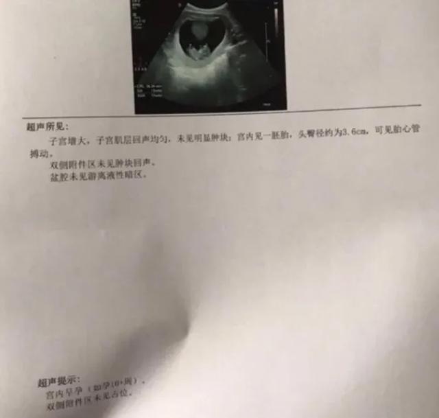 武汉同济试管婴儿三代全国十大试管婴儿医院