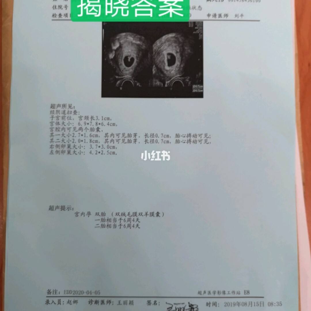 北医三院试管婴儿的流程协和医院试管婴儿成功率