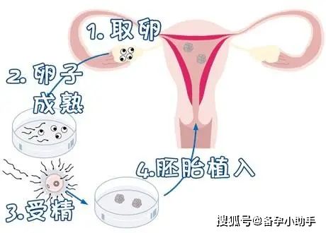 试管婴儿一代成功率有多少(做一代的试管婴儿需要多少钱)