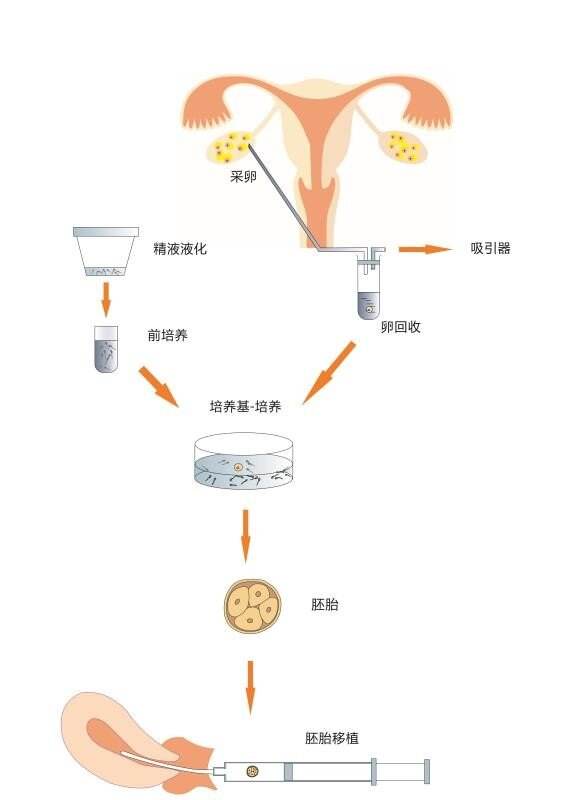 关于做试管婴儿全部费用大概是多少的信息
