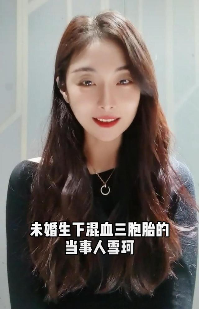 试管婴儿漂亮(试管婴儿为什么长得丑)
