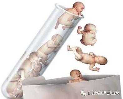 夫妻怎样做试管婴儿 夫妻怎样做试管婴儿