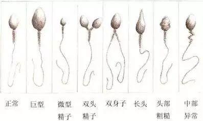 试管婴儿弱精 试管婴儿弱精