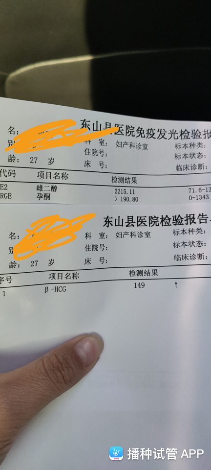 雌二醇试管婴儿(促排期间雌二醇对照表)