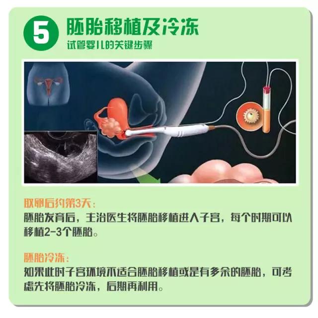 试管婴儿费用明细 试管婴儿费用明细