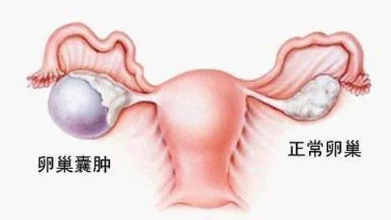 艾灸试管婴儿(移植前调内膜艾灸肚子)