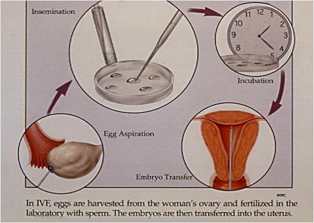 上海试管婴儿费用 上海试管婴儿费用