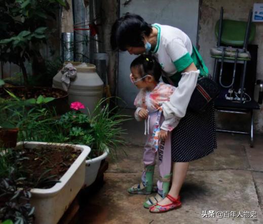 试管婴儿脑瘫 试管婴儿脑瘫