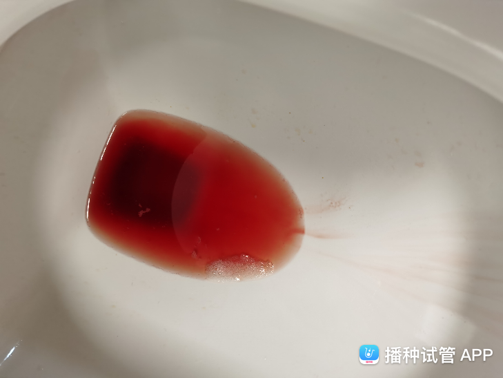 试管婴儿出血(我做试管婴儿的后遗症)