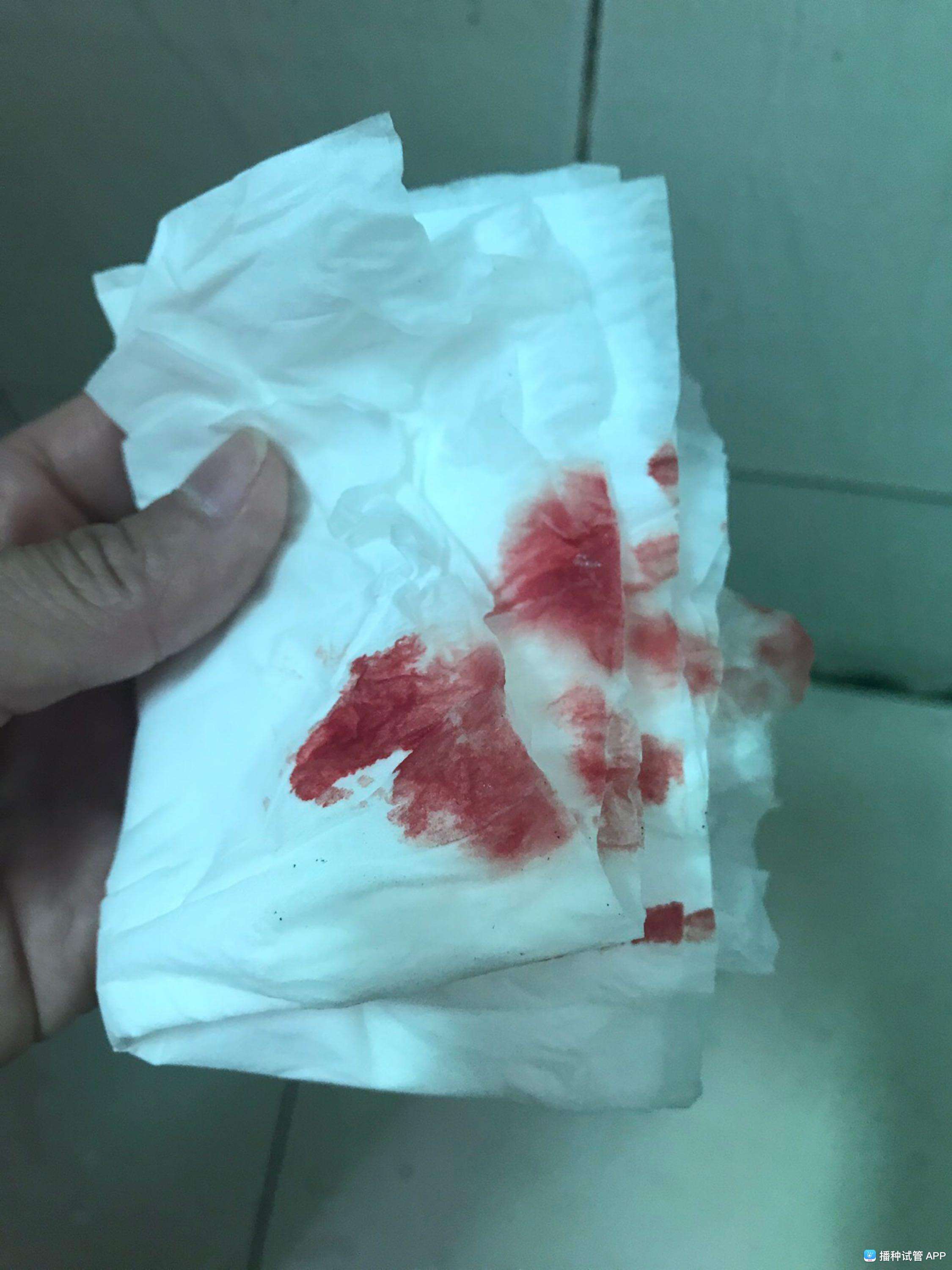 试管婴儿出血(我做试管婴儿的后遗症)