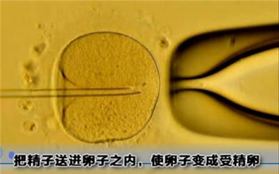 试管婴儿怎么放入子宫 试管婴儿怎么放入子宫
