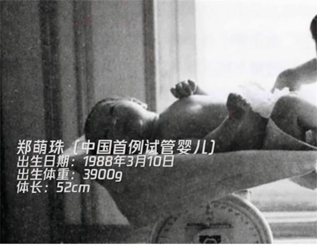 试管婴儿健不健康 试管婴儿健不健康