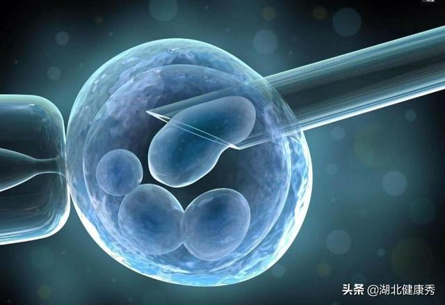 子宫纵隔试管婴儿 子宫纵隔试管婴儿