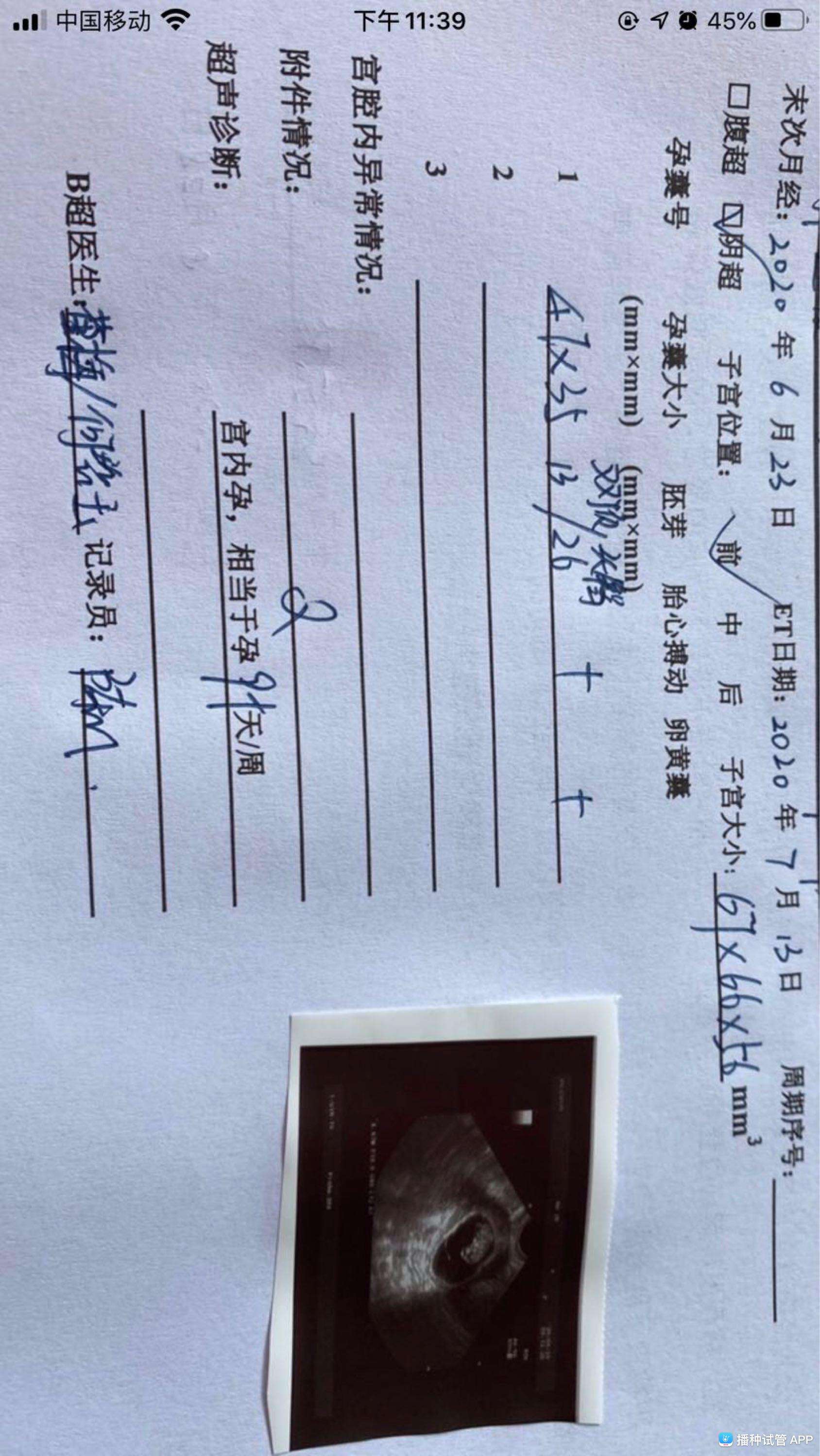 播种网试管婴儿做试管10大忠告