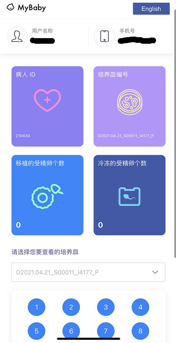 试管婴儿体外 试管婴儿体外