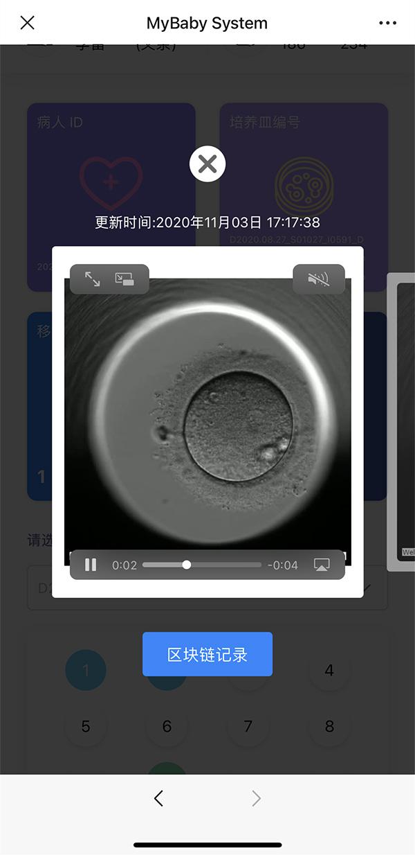 试管婴儿体外 试管婴儿体外