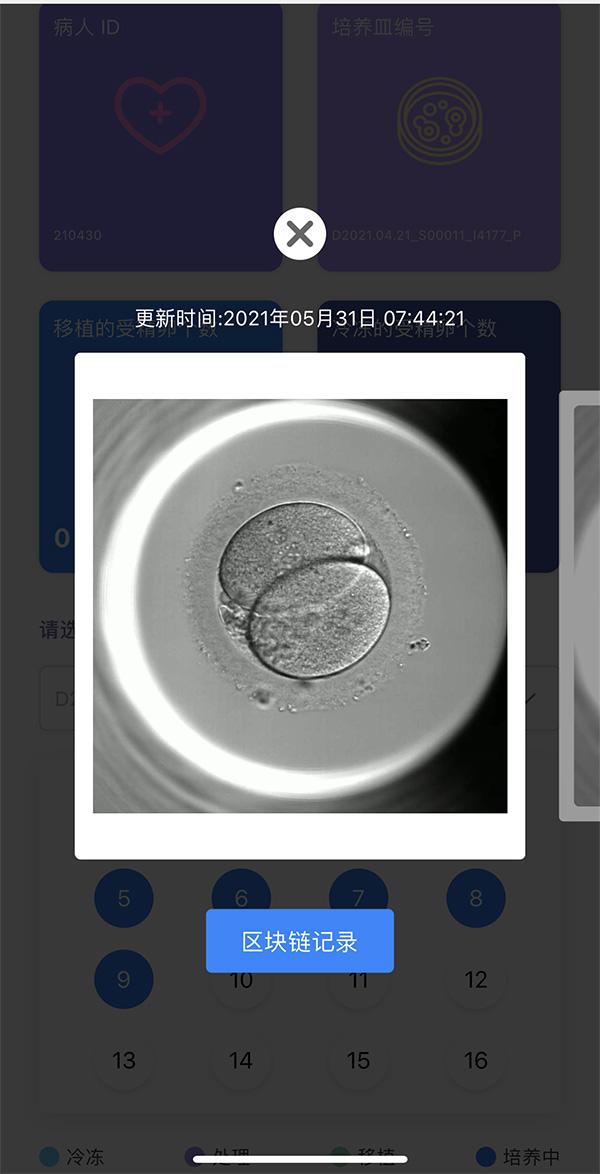 试管婴儿体外 试管婴儿体外