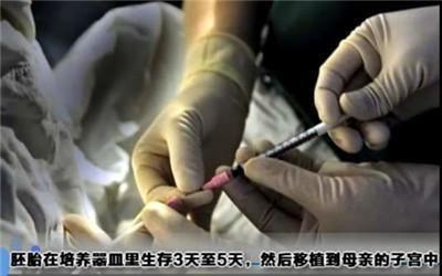 女人做试管婴儿疼吗 女人做试管婴儿疼吗